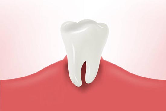 <b>牙龈肿痛怎么办？哪些方法能缓解牙龈肿痛？</b>