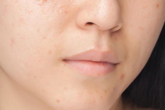 ��ǳ��տ���ʲôԭ��,�տ�