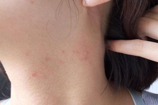 ���ӳ��տڷ۴���ʲôԭ��,